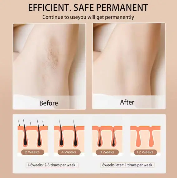 Babyverse™ Digital IPL Hair Removal Device – Painless Permanent Hair Reduction Beautimech