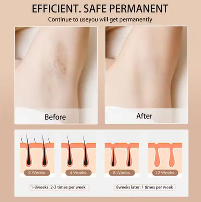 Babyverse™ Digital IPL Hair Removal Device – Painless Permanent Hair Reduction Beautimech